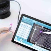 PlatR is an innovative solution for reliable manual pipetting to microtiter plates