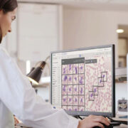 Siemens Healthineers to distribute Scopio Labs’ full-field digital cell morphology technology