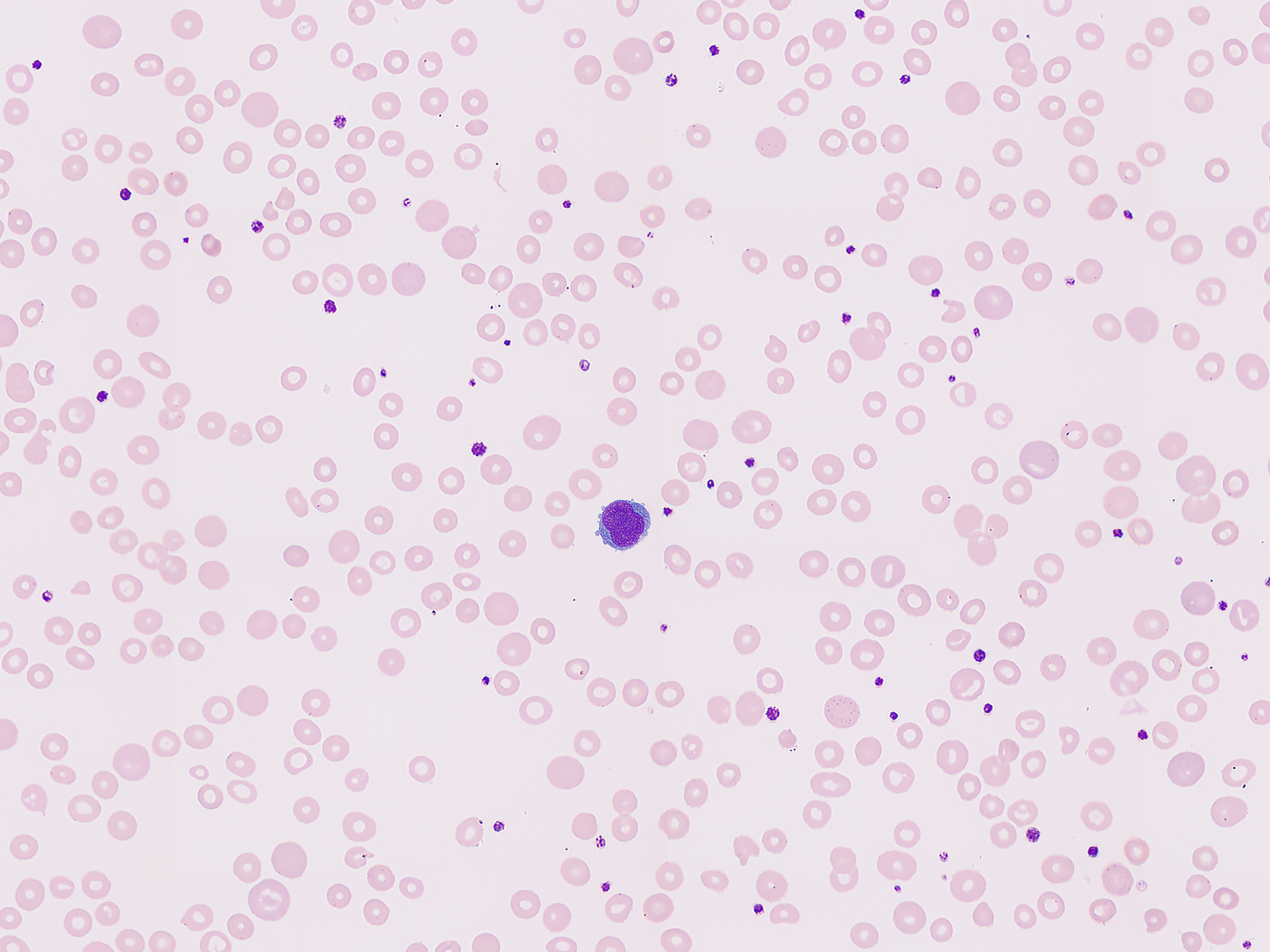blood cells image from Mindray