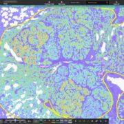 Indica Labs Lung Macrodissect AI