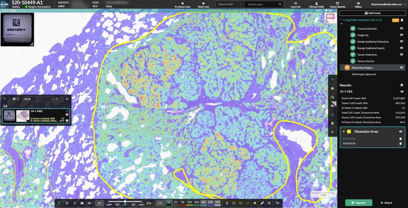 Indica Labs Lung Macrodissect AI