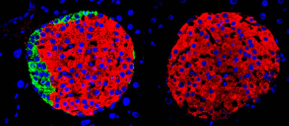 Pancreatic islets