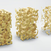 osteolabs partners with Swiss laboratory to deploy calcium isotope breakthrough 8 AdobeStock 143621645