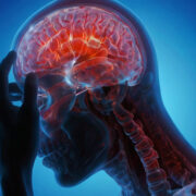 The evolving paradigm of delayed cerebral ischemia 10 AdobeStock 1535491428