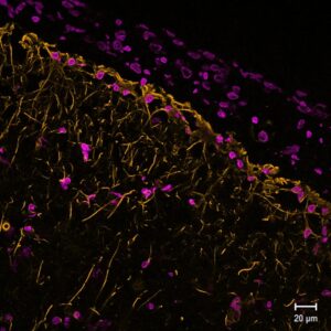 Biotium introduces MiniMab™ SdAb series targeting GFAP, SYT1, and VGLUT1 for enhanced super-resolution microscopy in neuroscience research applications.