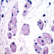 Early results suggest bile acids may be useful as diagnostic and prognostic markers for bone and muscle diseases 5 AdobeStock 1402677677