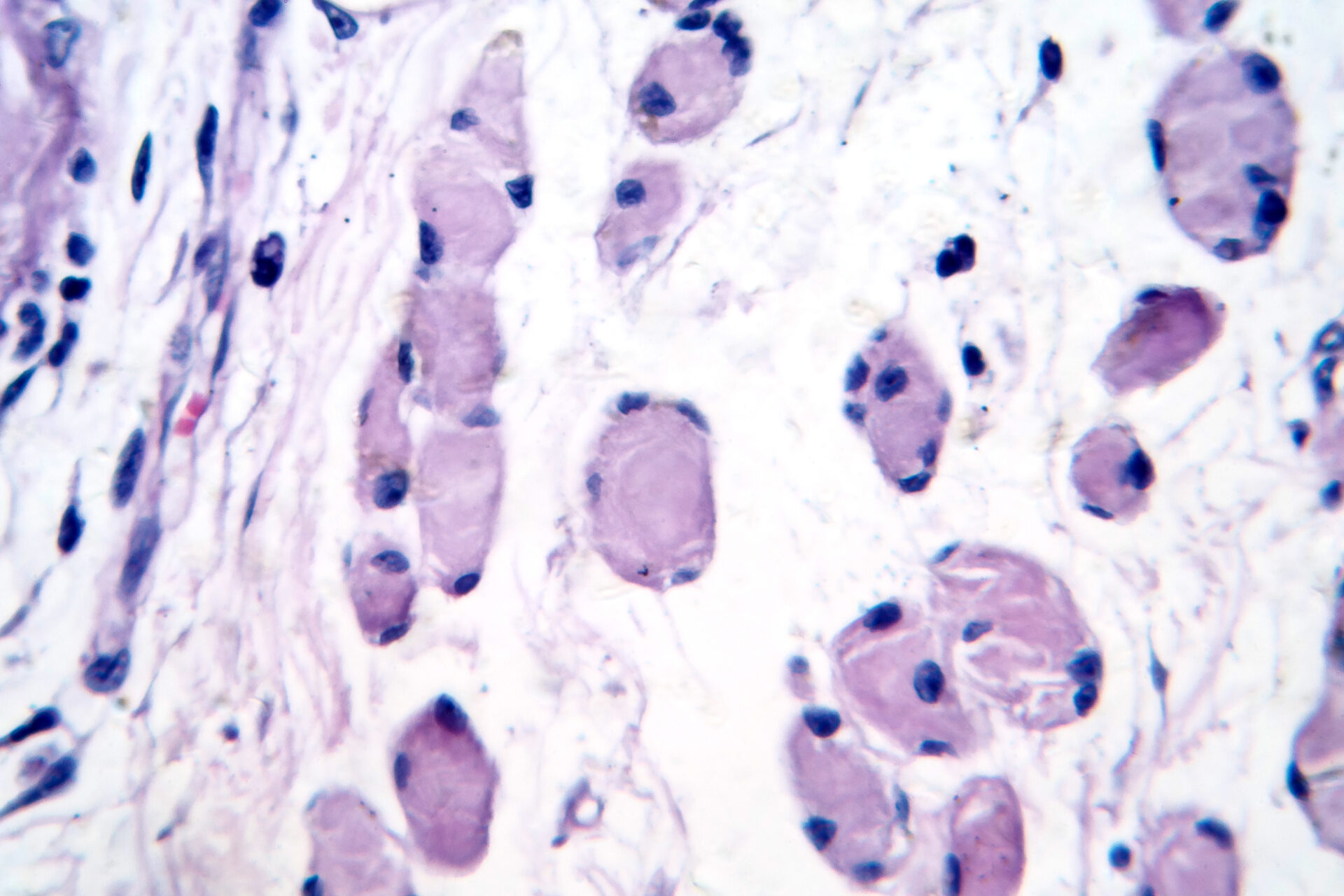 AdobeStock 1402677677