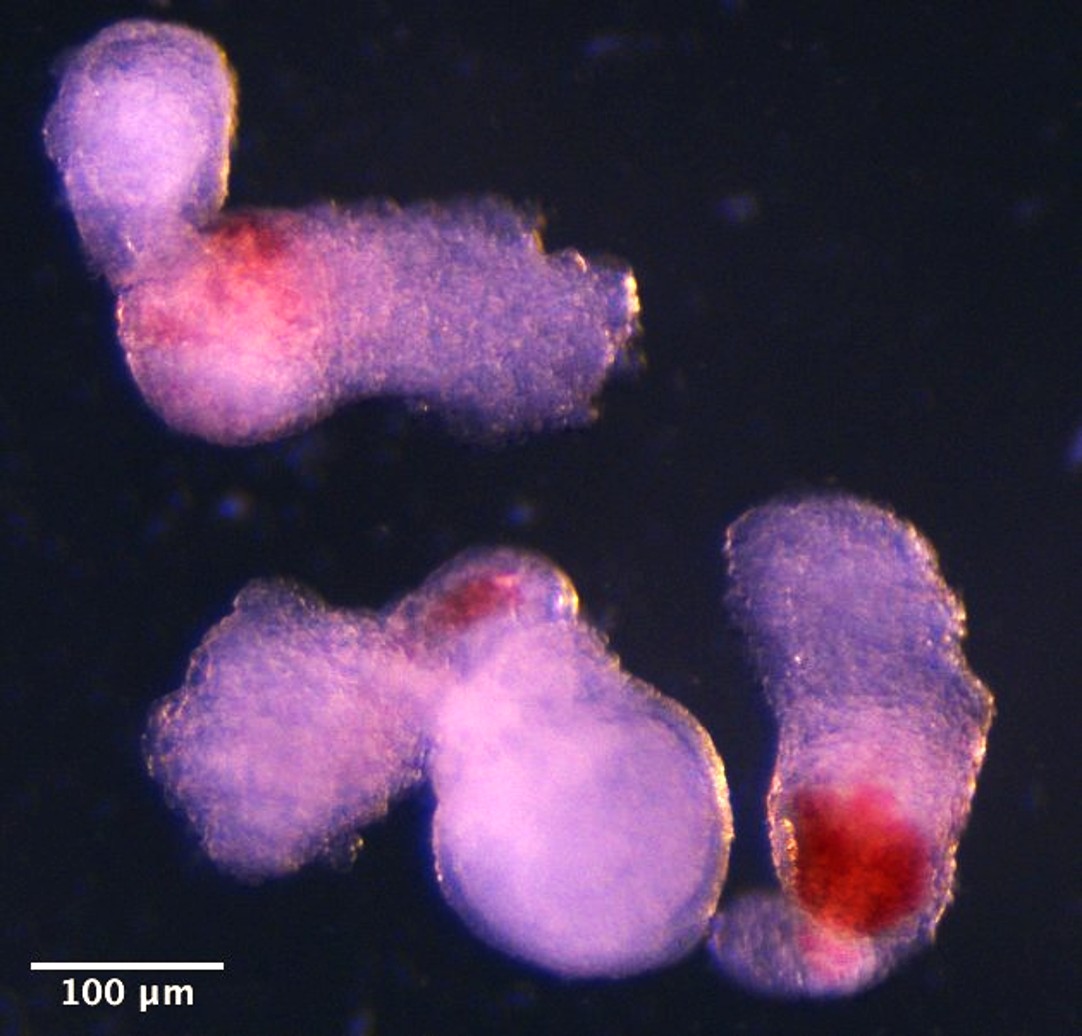 Day 14 hematoids Day 14 hematoids