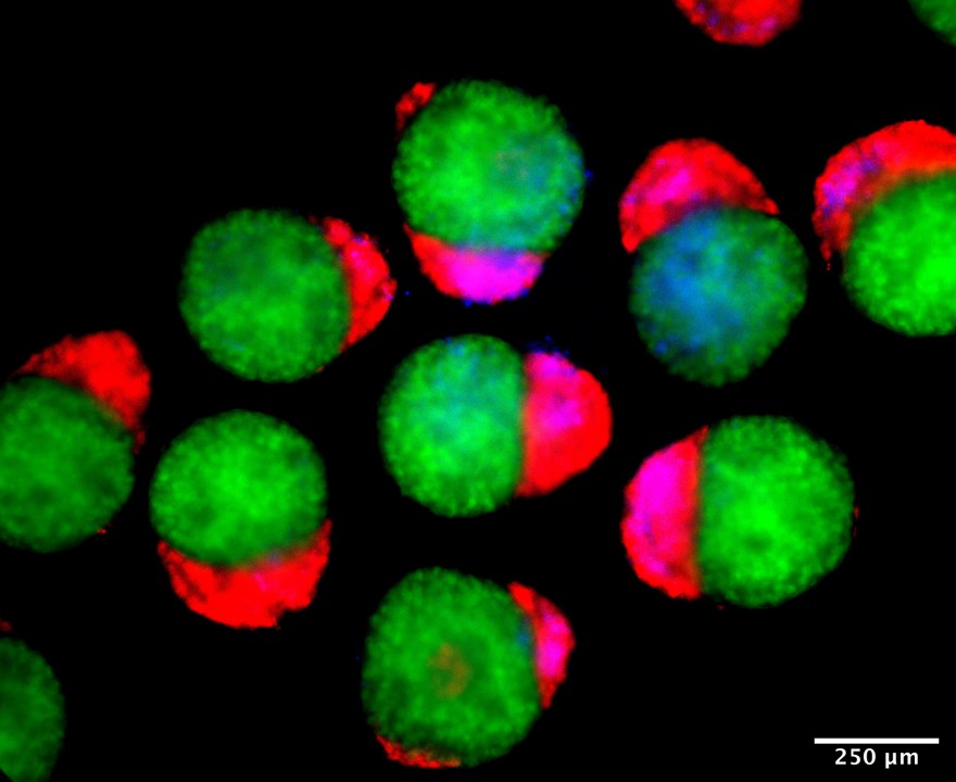 Day 4 hematoids. Day 4 hematoids
