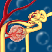 glomerulonephritis ist eine gruppe von nierenerkrankungen die durch eine entzuendung der glomeruli in der niere gekennzeichnet sind