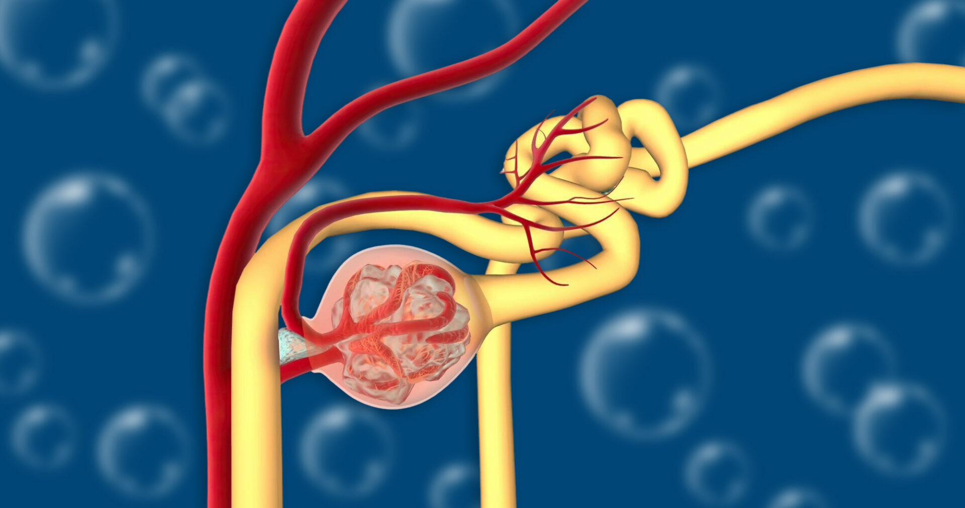 glomerulonephritis ist eine gruppe von nierenerkrankungen die durch eine entzuendung der glomeruli in der niere gekennzeichnet sind