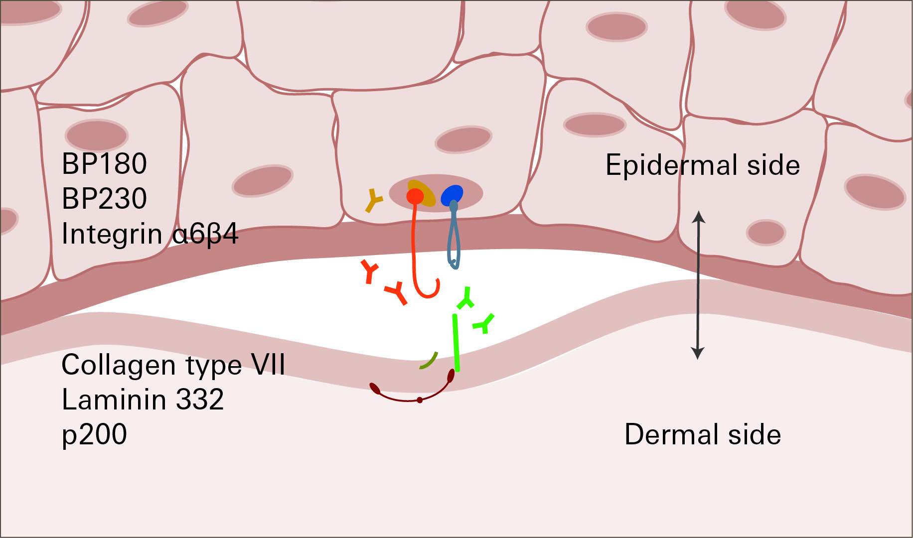 Fig2 Salt Split skin