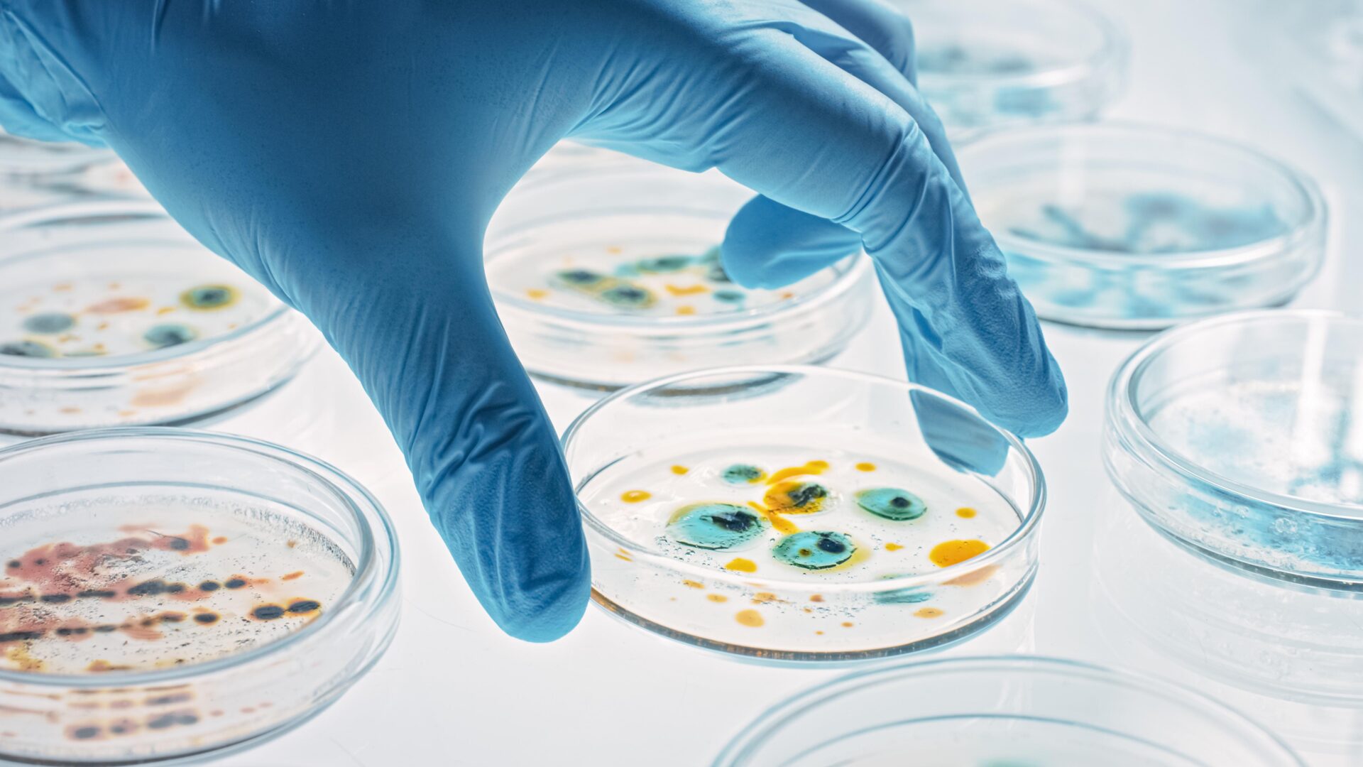 Scientist Works with Petri Dishes with Various Bacteria, Tissue AdobeStock 330354724