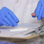 Novel home finger-prick blood test detects Alzheimer’s disease pathology 5 AdobeStock 347979263