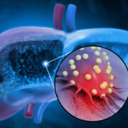 EVerZom signs research collaboration with GENFIT to advance exosome therapy 1 AdobeStock 458919499