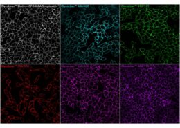 Biotium launches GlycoLiner kits for cell surface labelling 3 Biotium GlycoLiner