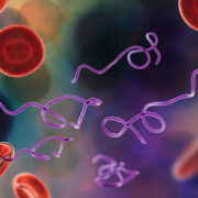 Single-tier testing improves diagnosis of Lyme disease 2 Lyme Disease Borrelia burgdorferi Serologic tests Early diagnosis Biomarkers