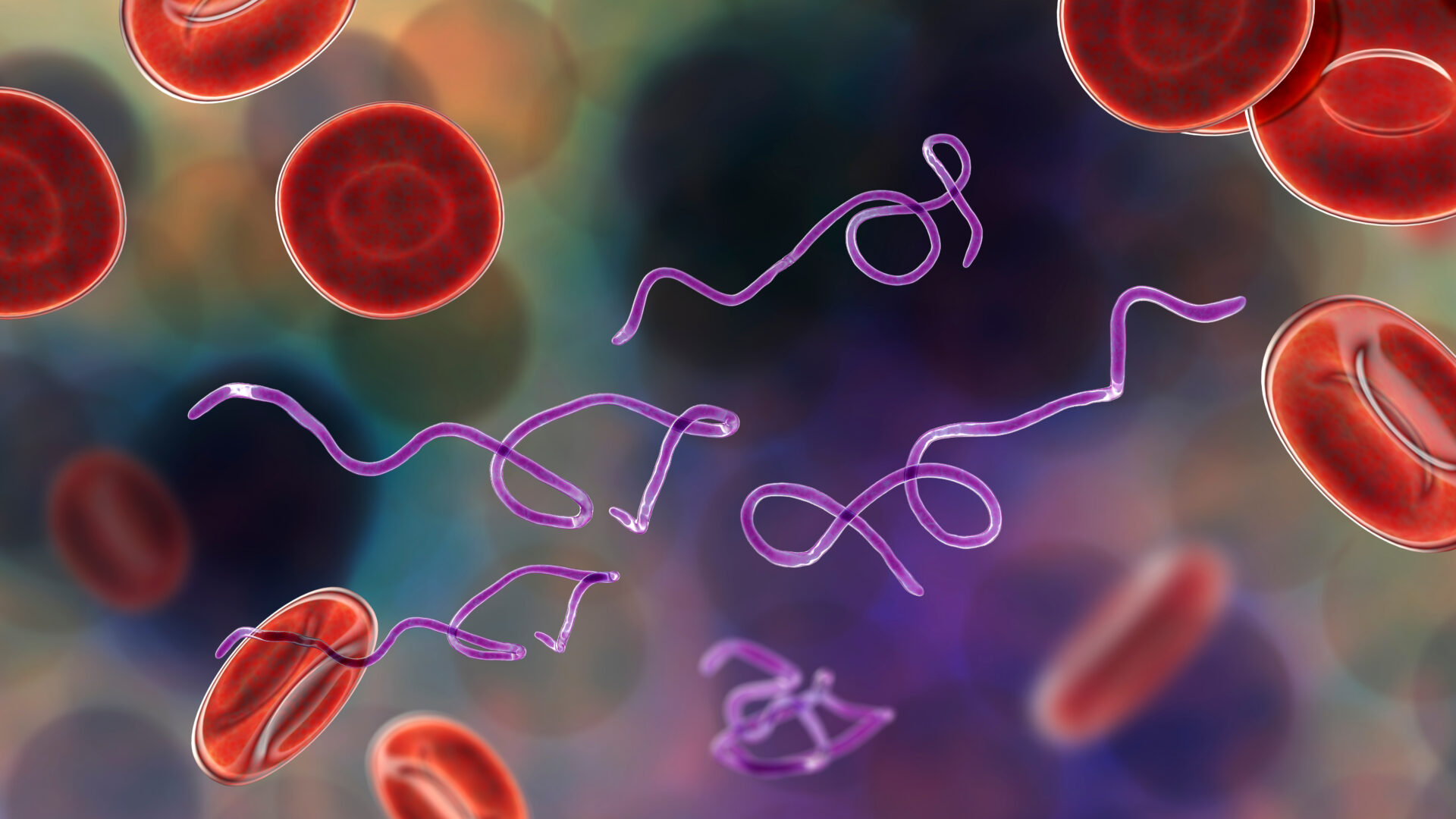 Borrelia bacteria in blood Lyme Disease Borrelia burgdorferi Serologic tests Early diagnosis Biomarkers