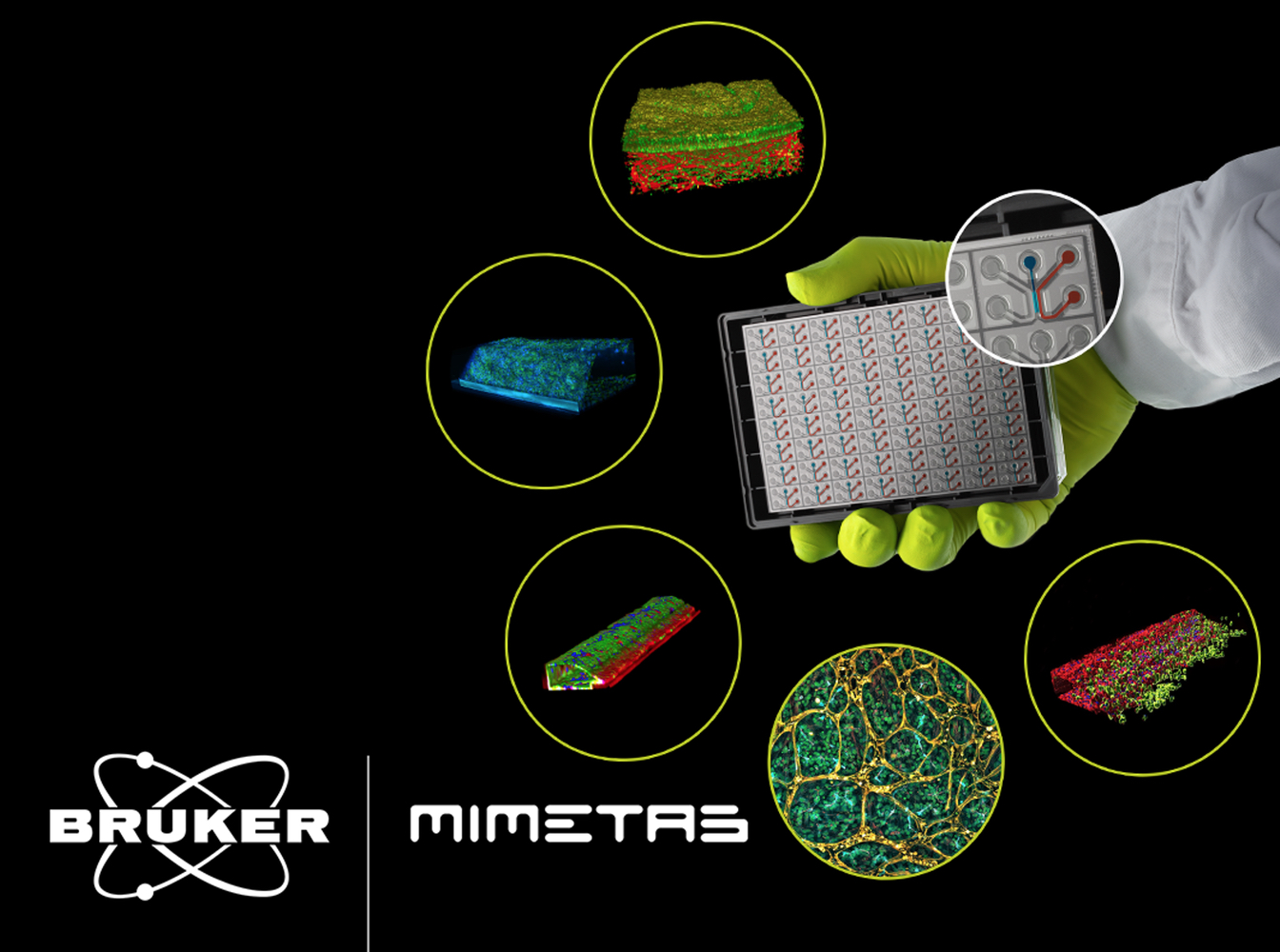 brucker_mimetas brucker mimetas