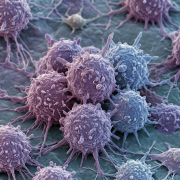 New patient-derived cancer models unveiled for global research 8 cancer cells